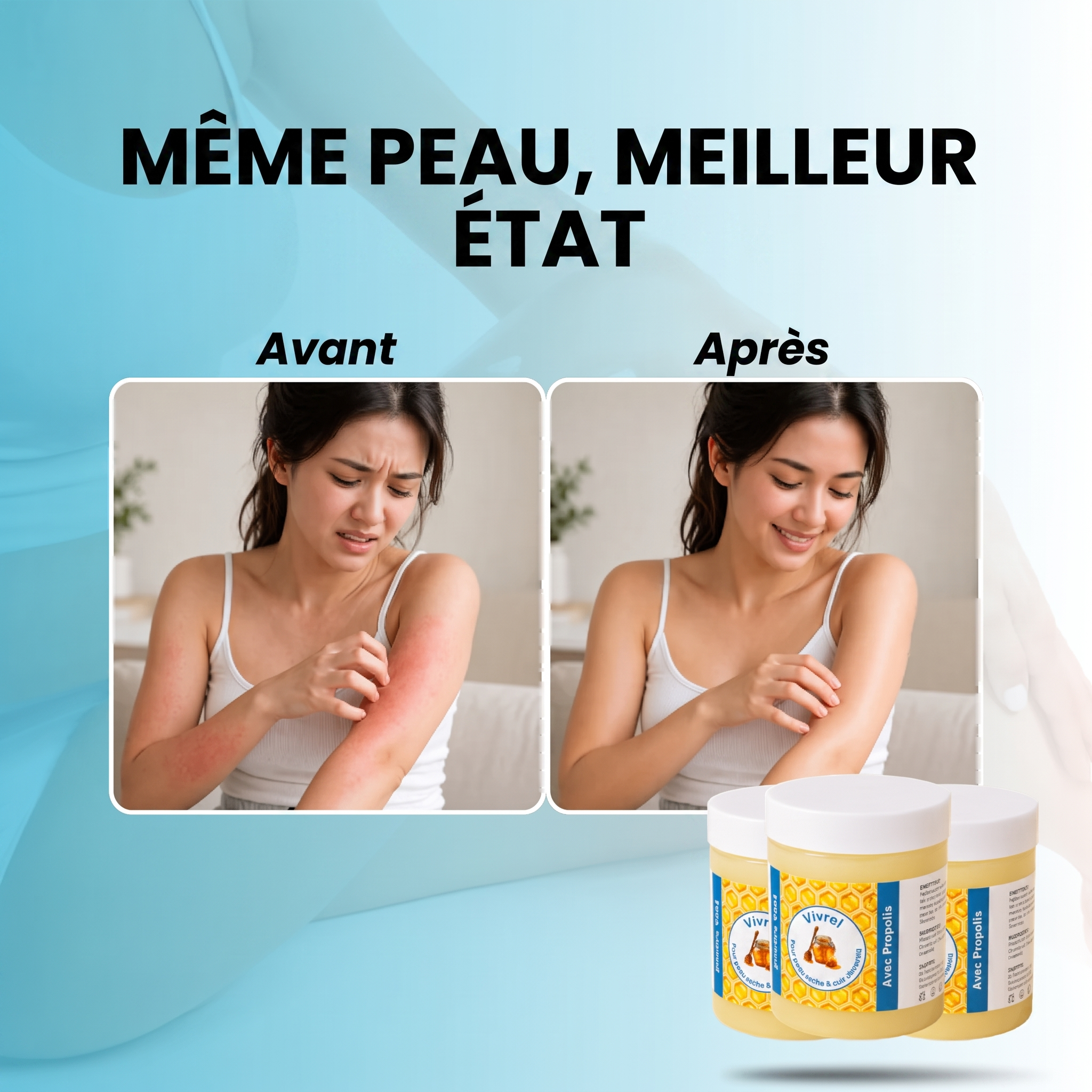 Vivrel - Baume Réparateur pour Eczéma et Psoriasis
