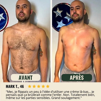crème dépilatoire