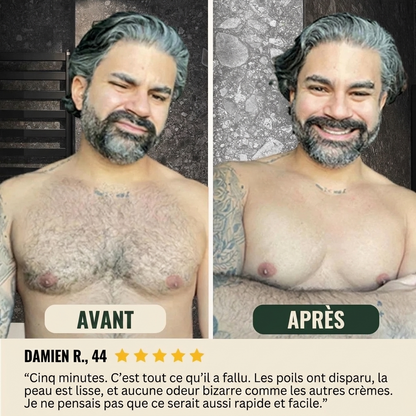 crème dépilatoire